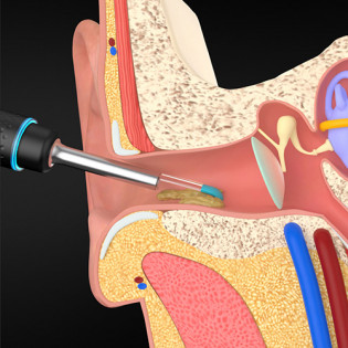 Bebird Smart Visual Ear Pick M9 Pro